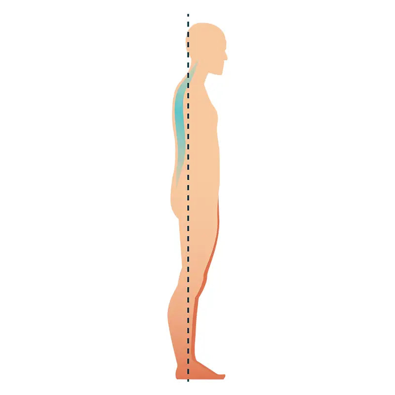 Image showing Flat Back posture.
